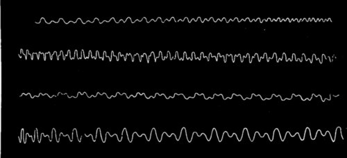 WAVE SHAPES