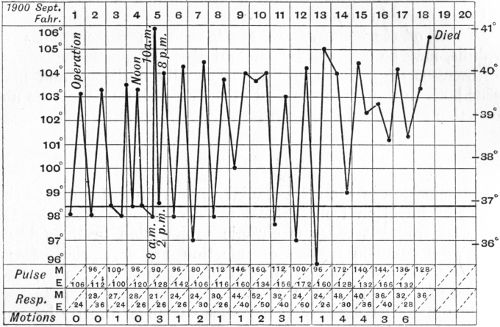 Fig. 196.—Chart of case of Sinus Phlebitis following middle ear disease in a boy æt. 13.