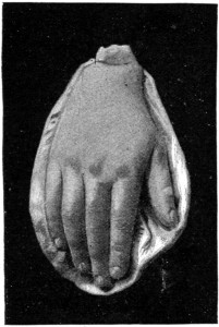 PRINCESS ALICE'S HAND.