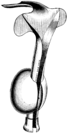 Auvard’s Self-retaining Speculum