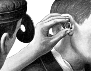 Examination of the Ear