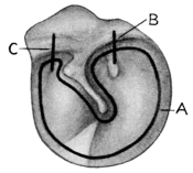 Lines of Incisions in Intratympanic Operations