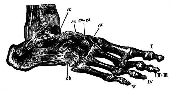 Syndactyly in the Foot