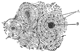 CROSS SECTION OF COMPACT BONE FROM THE SHAFT OF THE HUMERUS  A, bone cells; B, blood capillaries. (From Martin’s “Human Body”)