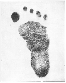 THE BABY’S FOOTPRINT  A means of positive identification