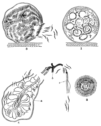 FIG. 3.—FORMATION OF THE BLASTS OF HÆMOMENAS PRÆCOX (ROSS) WITHIN THE BODY OF THE MOSQUITO ANOPHELES. MAGNIFIED 2,000 TIMES. AFTER ROSS AND FIELDING-OULD.  No. 1, The full-grown zygote dividing up into meres; No. 2, an isolated mere which has developed its filiform bodies or blasts; No. 3, the zygote crammed with blasts is bursting; No. 4, the blasts are making their way into the salivary gland of the mosquito a, through it into the œsophagus b, and finally into the proboscis c.  To face page 144.