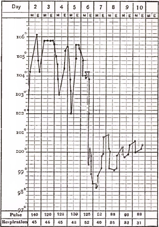 A Case of Lobar Pneumonia in a Boy ten years old