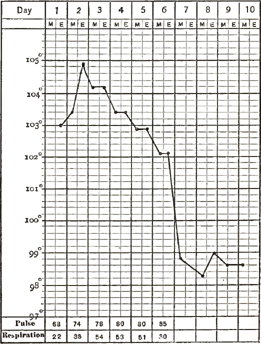 A Typical Case of Senile Lobar Pneumonia: Recovery