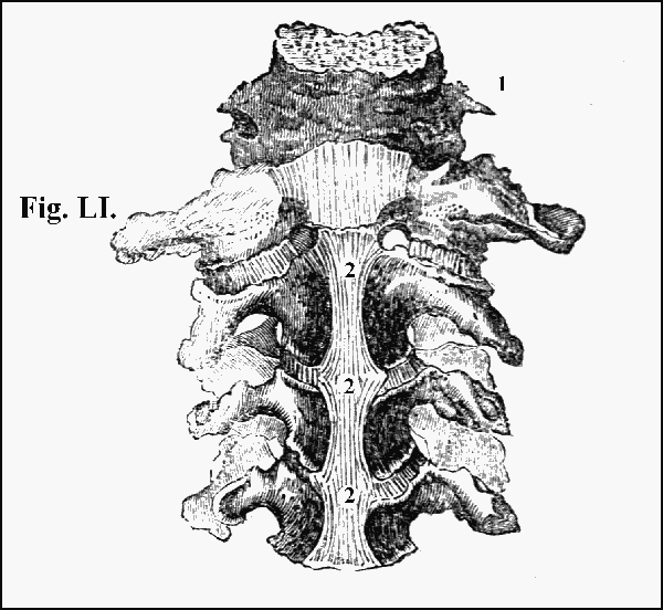 Fig. LI.