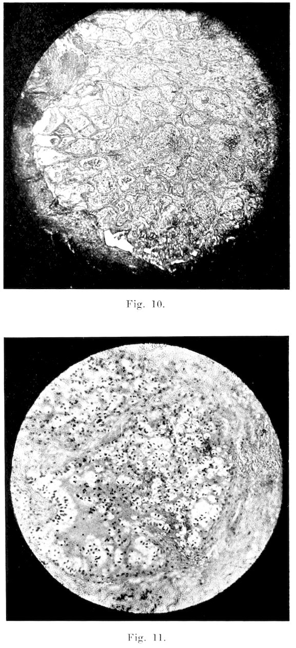 Fig. 10. Fig. 11.