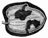 Fig. 68.—Gallery formed by larva of Dacus ole.