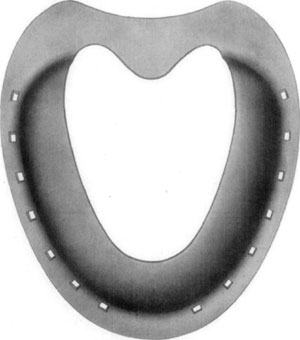 Fig. 36—Superior surface, showing concavity or bowl, as formed by the toe and branches of the shoe, as designed by Dr. David W. Cochran.