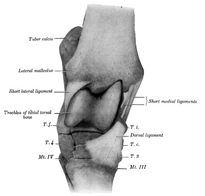 Fig. 54—Right hock joint. Viewed from the front and slightly laterally after removal of joint capsule and long collateral ligaments. T.t., Tibial tarsal bone (distal tuberosity). T.c., central tarsal bone. T.3. Ridge of third tarsal bone. T.f. Fibular tarsal bone (distal end). T.4. Fourth tarsal bone. Mt. III, Mt. IV. Metatarsal bones. Arrow points to vascular canal. (From Sisson's ''Anatomy of the Domestic Animals.'')