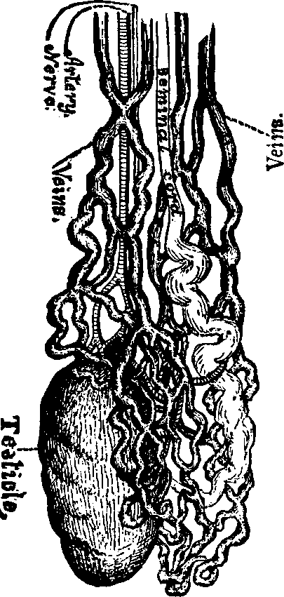 Illustration: Fig. 3. Well developed Varicocele.