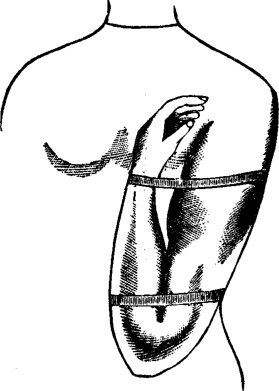 Illustration: Fig. 2. Mode of employing flexion for the arrest of hemorrhage from a wound located below the elbow. 