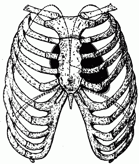 Fig. 13