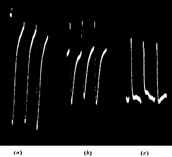 Fig. 67.—Negative, Diphasic, and Positive Resultant Response