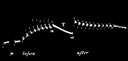 Fig. 75.—Abnormal Positive (up) Response in Nerve Converted into Normal (down) Response after Continuous Stimulation T (Waller)