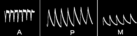 Fig. 112.—Uniform Responses in (A) Nerve, (P) Plant, and (M) Metal