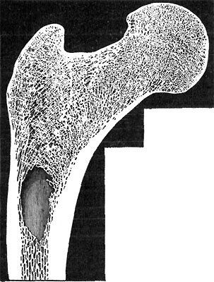 LENGTHWISE SECTION OF BONE