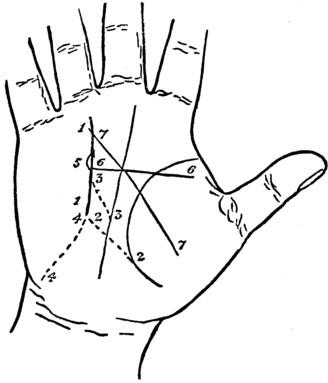 Plate XV. THE LINE OF SUN AND ITS MODIFICATIONS.