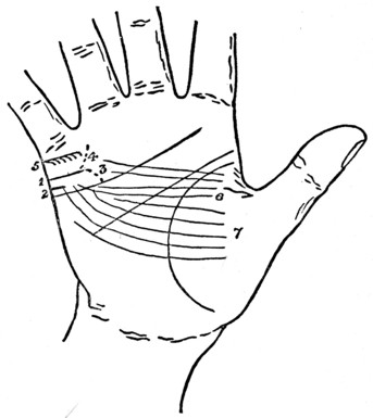 Plate XVII. MARRIAGE LINES. THE LINE OF MARRIAGE.