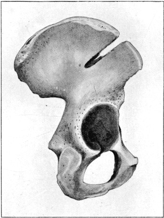 Fig. 55.