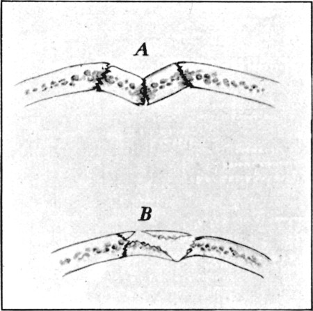 Fig. 65.