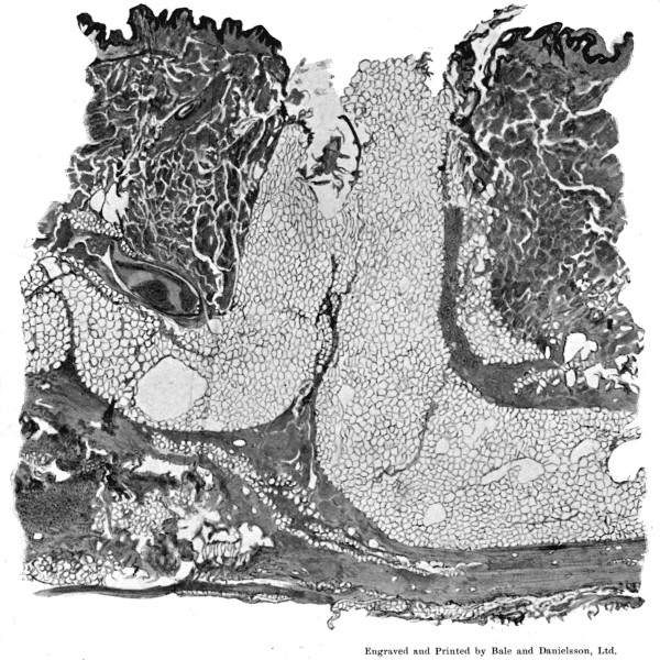 PLATE II