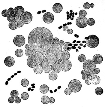 Fig. 5. Microscopic appearance of milk showing relative size of fat globules and bacteria.