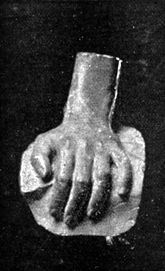 COMTE DE LORGE'S HAND.