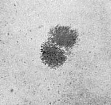 Two Colonies of Bacillus Acidophilus from Calves' Manure