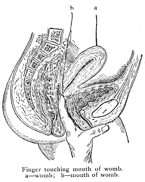 Finger touching mouth of womb. a—womb; b—mouth of womb.