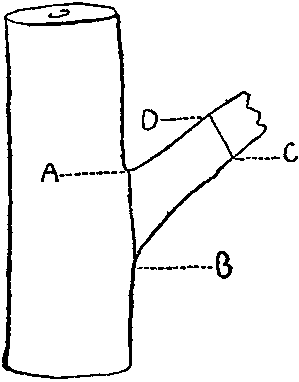 When a broken stump, such as is here shown, has to be sawn off, the proper place to amputate it is from A to B; the wrong place from C to D.