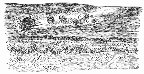 57. Sarcoptes scabiei. Diagrammatic representation of the course in the skin of man.