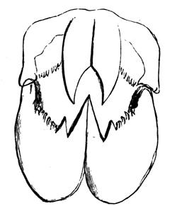 Jaws of Dinichthys Hertzeri.