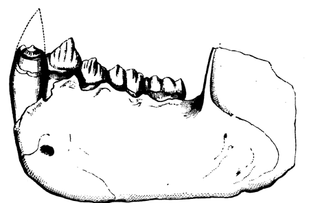 Lower Jaw of Dryopithecus   Fontani.