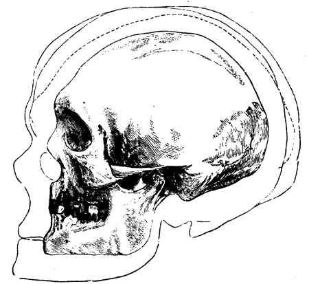 Outlines of Three Prehistoric   European Skulls compared with an American Skull from   Hochelaga.