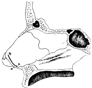 Incision for Submucous Resection of the Septum