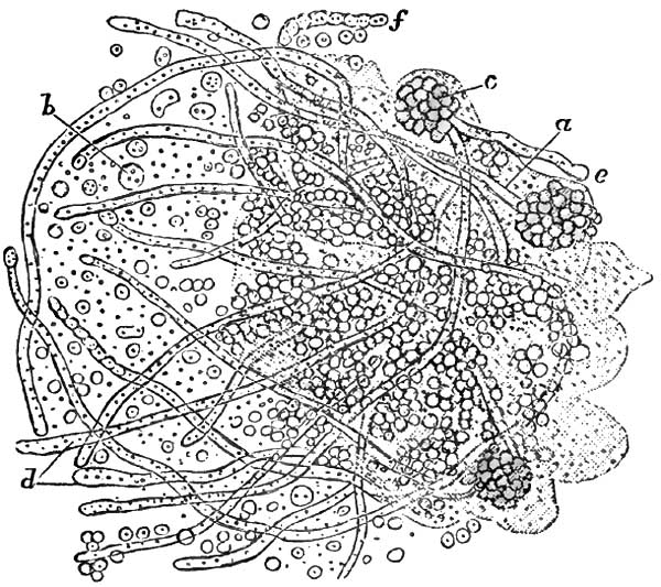 Oïdium albicans