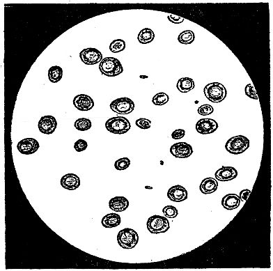 another slide of yeast