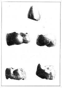 Tooth crowns found in an Etruscan tomb