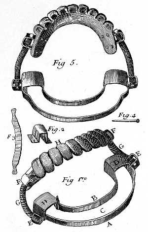 An upper denture