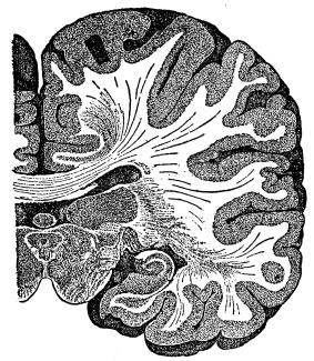 Fig. 10.—Frontal Section of the Right Cerebral Hemisphere.