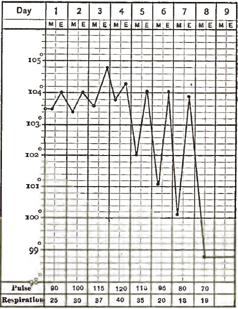 Lobar Pneumonia, where the Crisis was marked    with Evening Exacerbations