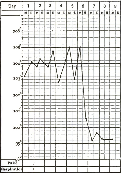 Acute Lobar (croupous) Pneumonia in a Child: Recovery