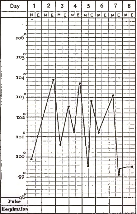 Acute Lobular (catarrhal) Pneumonia in a Child: Recovery