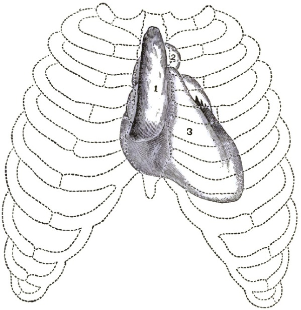 Sarcoma of the Mediastinum