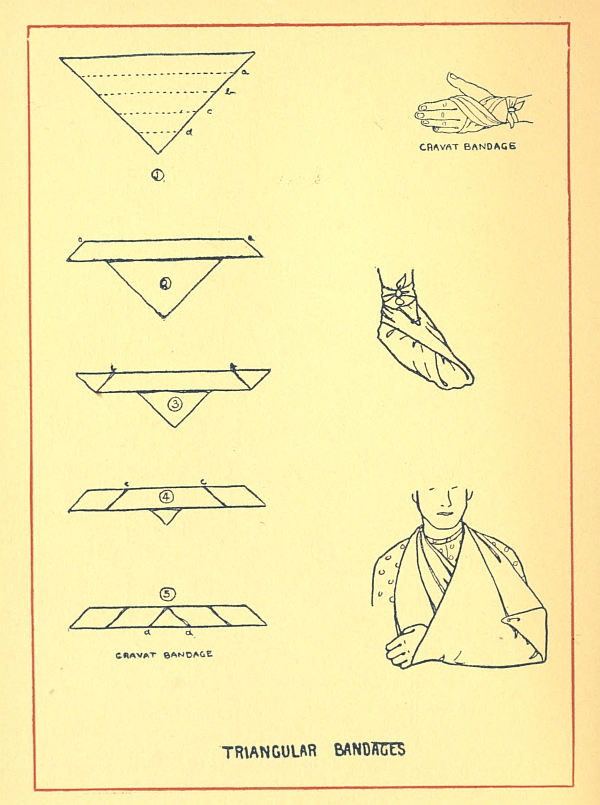 TRIANGULAR BANDAGES (second)