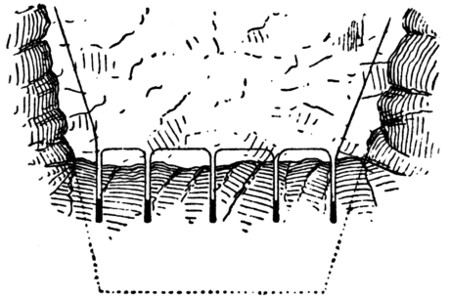 electric fuses